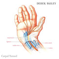 Derek Bailey Carpal Tunnel