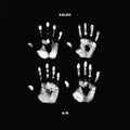 Kaleo A/B (Indie Exclusive) [Black & White Vinyl] [2LP]